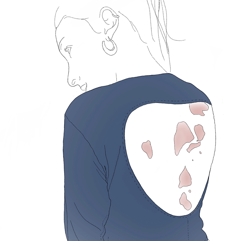 Project Dermis by Anna Vilageliu.