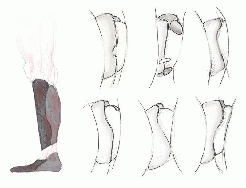 TFG of Gregorio Rojas at Eina - Extrem