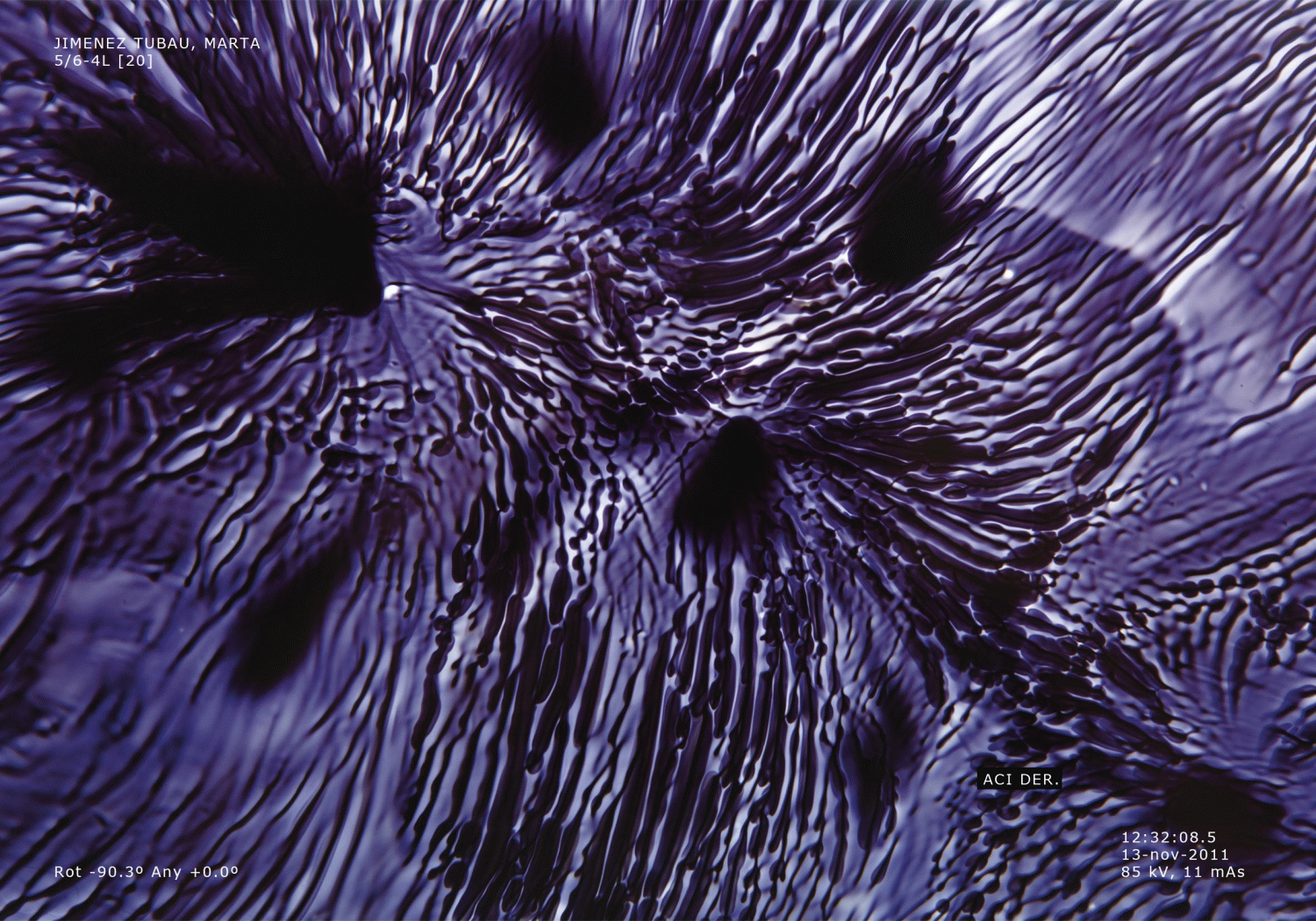 Macro de les papil·les gustatives la primera vegada que perdones