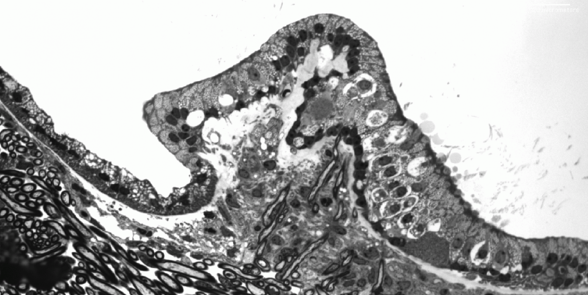 Inner ear pathology in MPS IIIB mice at 30 wks.png